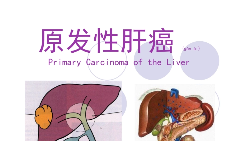 2022年医学专题—原发性肝癌-俞.ppt