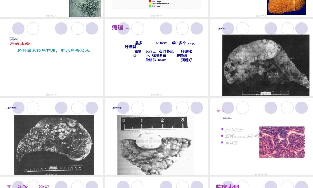 2022年医学专题—原发性肝癌-俞.ppt