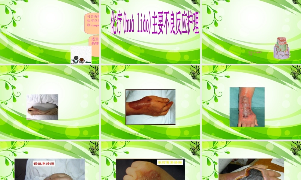 2022年医学专题—外科胃癌化疗前讲解.ppt