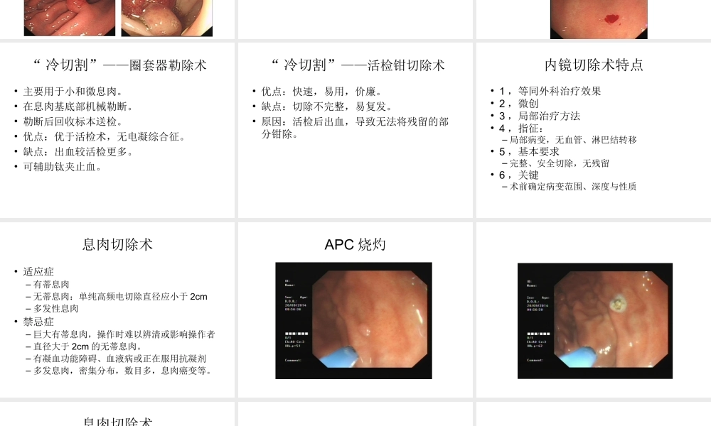 消化内镜切除术.ppt
