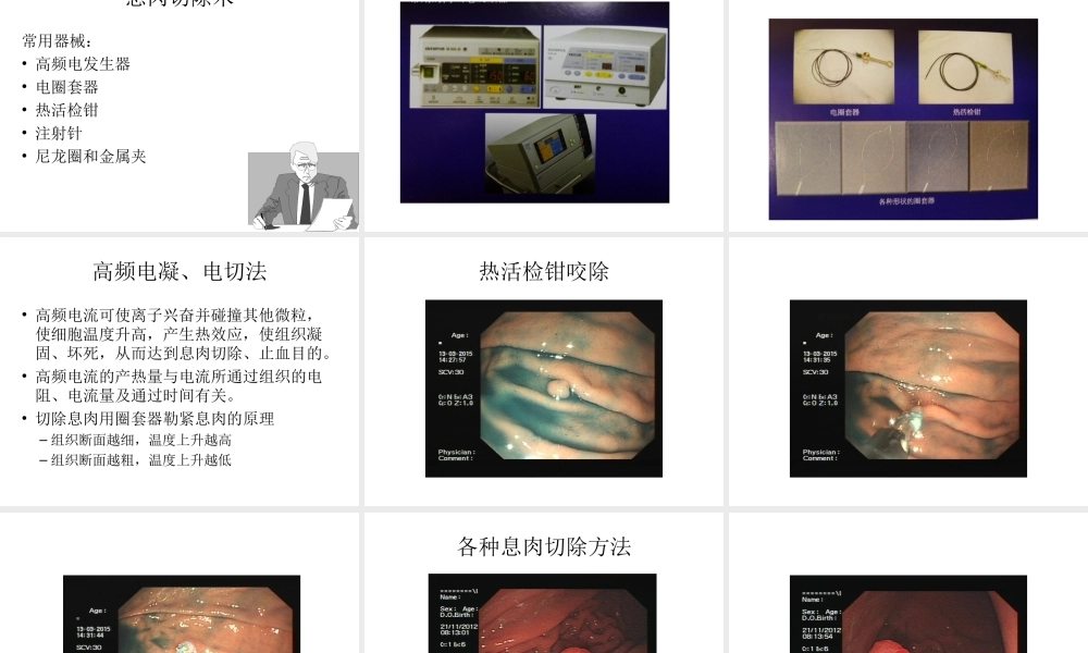 消化内镜切除术.ppt