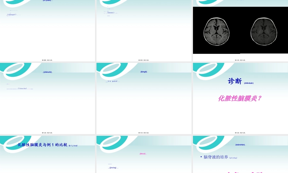 2022年医学专题—中枢神经系统感染白色念珠菌病--病例分享.ppt