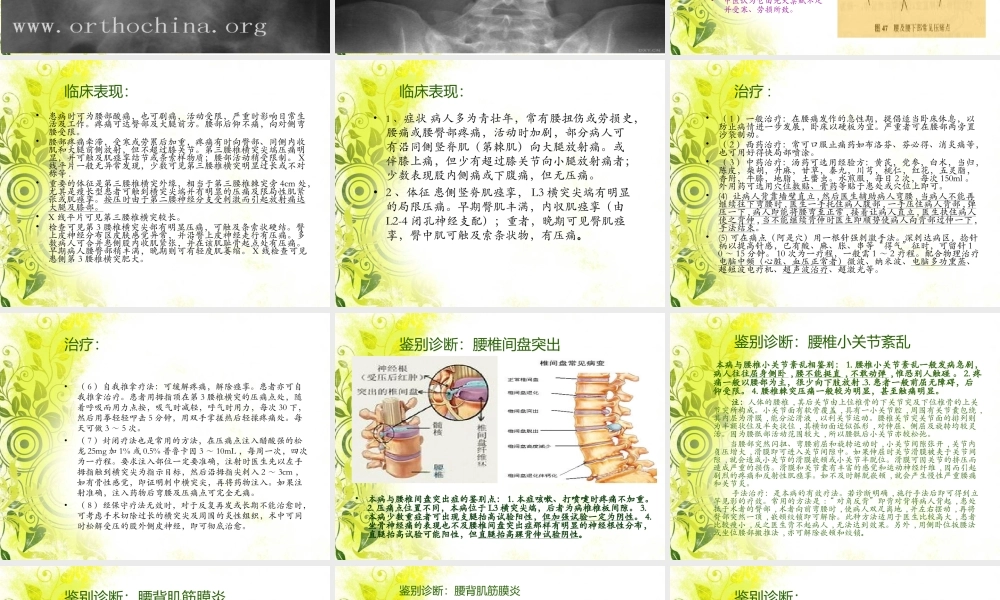 腰3横突综合症.ppt