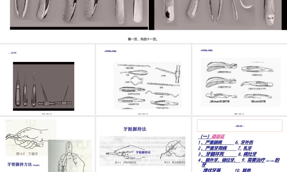 2022年医学专题—拔牙的过程如何.ppt