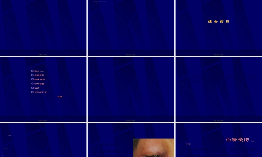 2022年医学专题—眼外伤.ppt