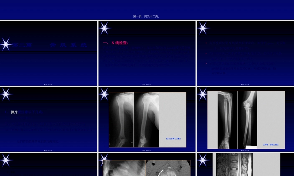 2022年医学专题—影像学骨肌系统.ppt