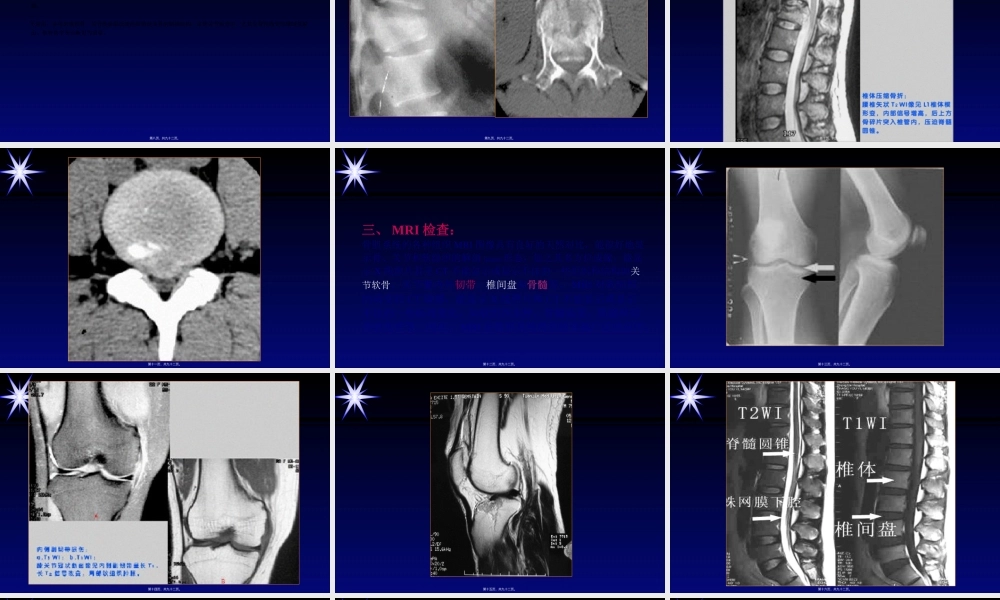 2022年医学专题—影像学骨肌系统.ppt