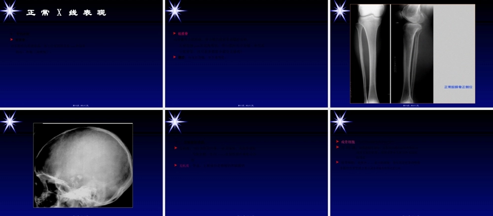 2022年医学专题—影像学骨肌系统.ppt