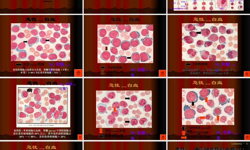 2022年医学专题—急性白血病化疗.ppt