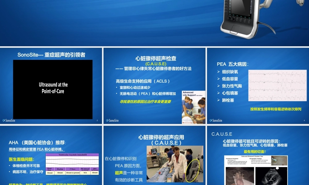 ICU-超声在心脏骤停应用.ppt