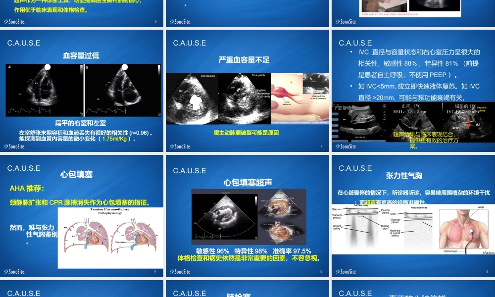 ICU-超声在心脏骤停应用.ppt