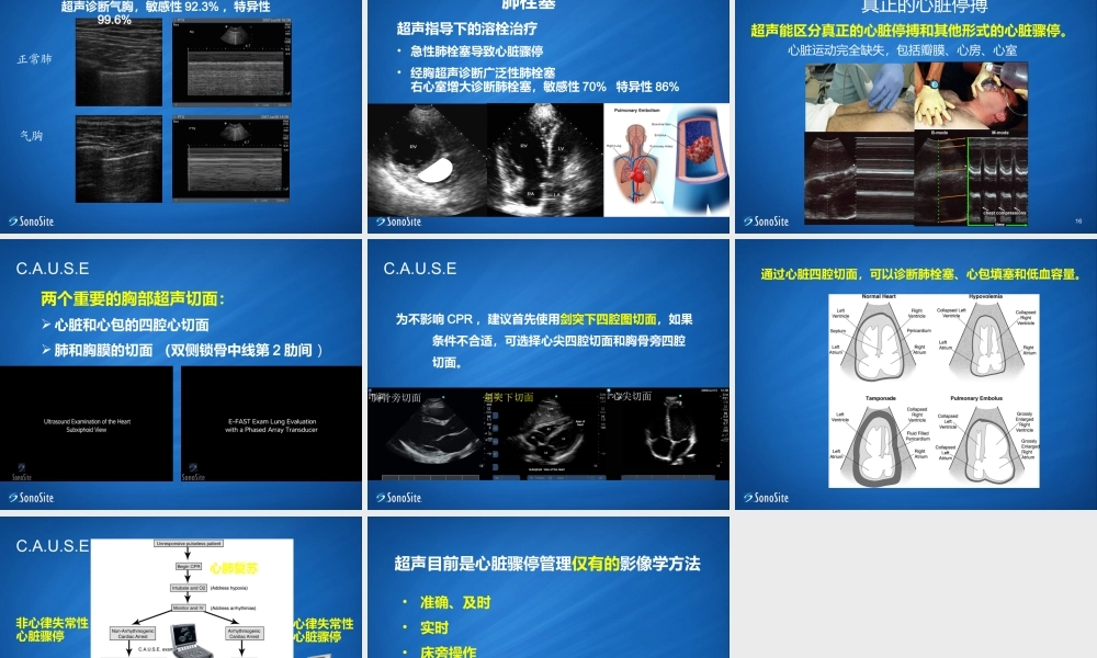 ICU-超声在心脏骤停应用.ppt