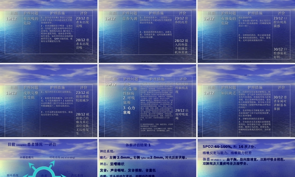 2022年医学专题—慢支急发患者查房.ppt