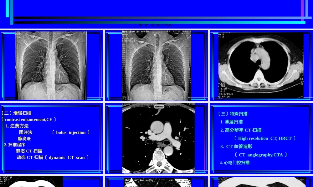 住院医师胸部CT诊(超量实例CT片).pptx