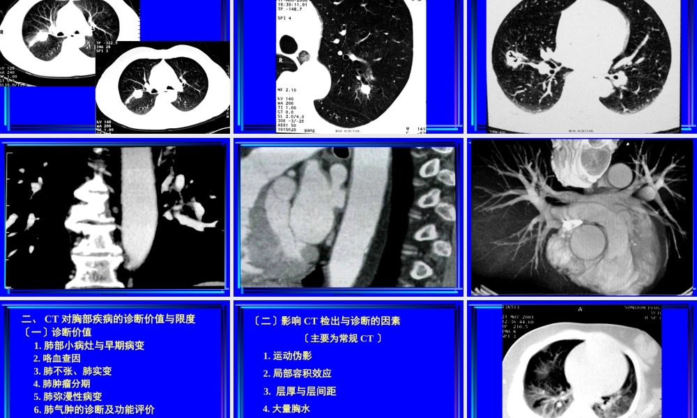 住院医师胸部CT诊(超量实例CT片).pptx