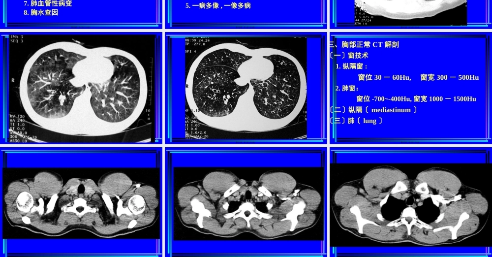 住院医师胸部CT诊(超量实例CT片).pptx
