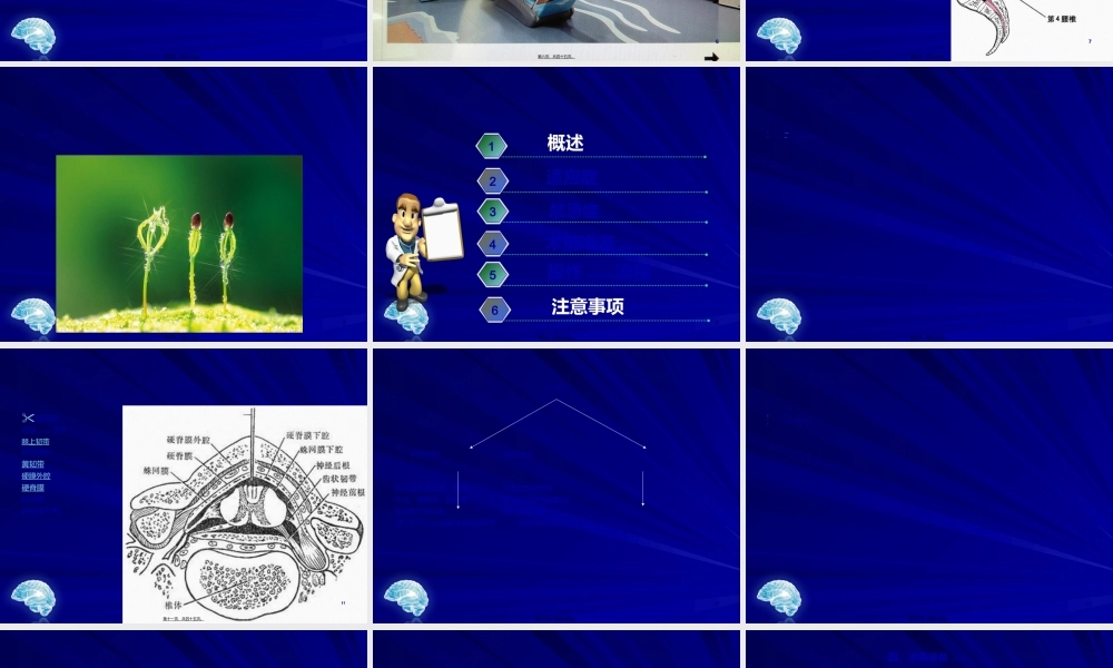 2022年医学专题—腰椎穿刺术.ppt