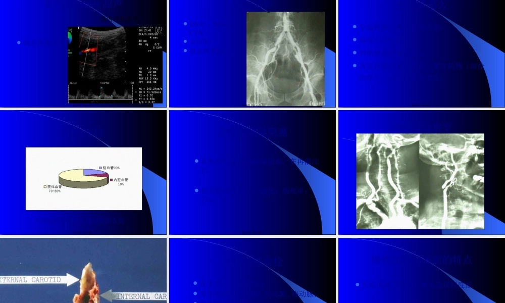 周围动脉血栓与栓塞.pptx