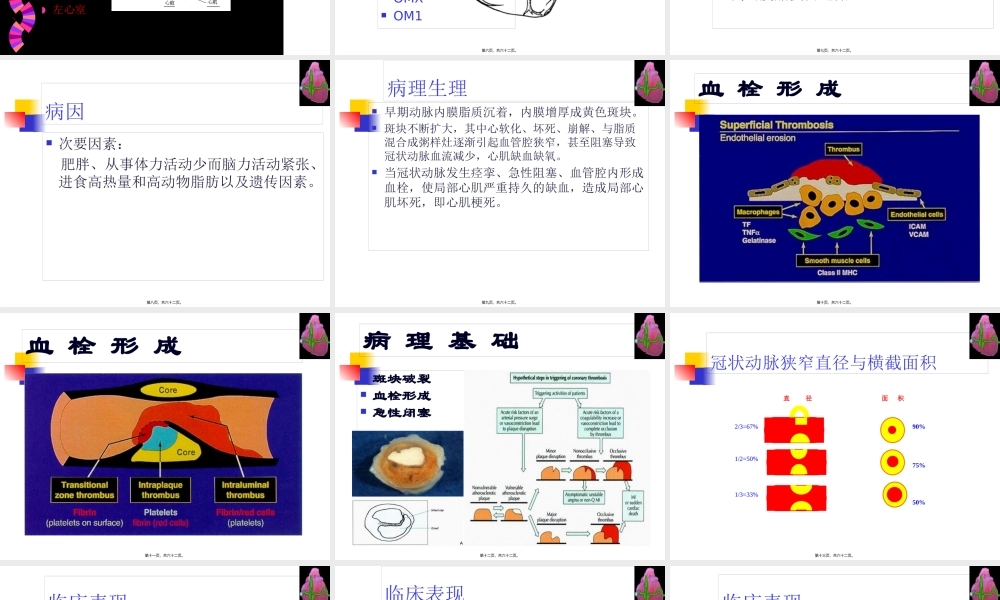 冠心病--河北--张成虎.pptx