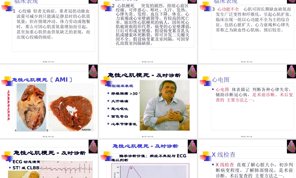 冠心病--河北--张成虎.pptx