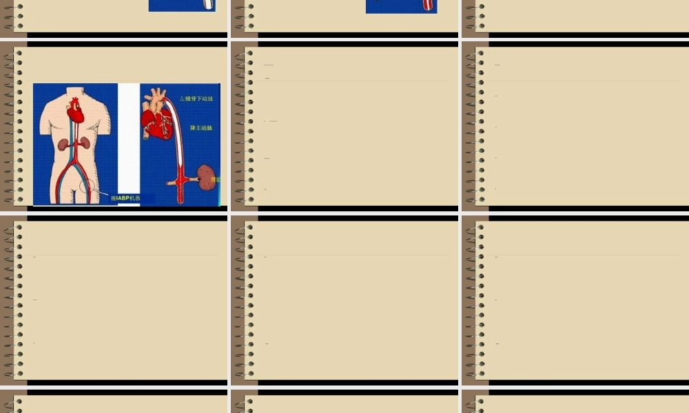 2022年医学专题—主动脉球囊反搏术(1).ppt