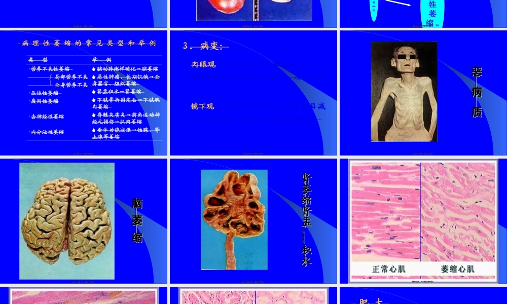 2022年医学专题—细胞组织损伤和修复.ppt