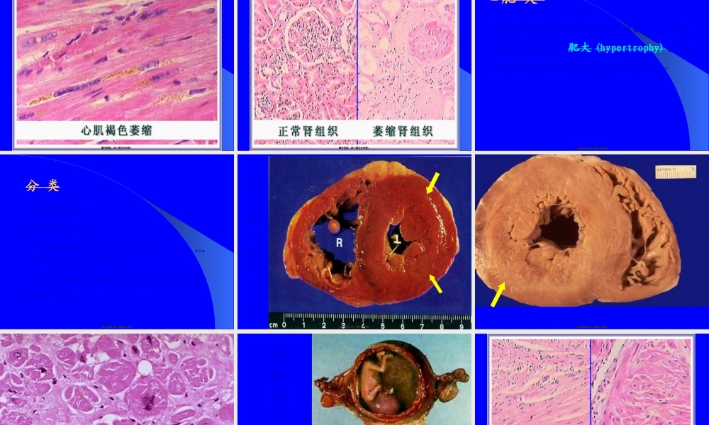 2022年医学专题—细胞组织损伤和修复.ppt