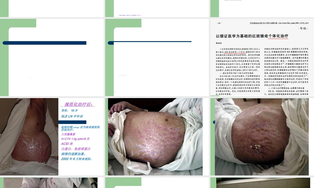 2022年医学专题—杨岫岩.系统性红斑狼疮(2015年省医).ppt
