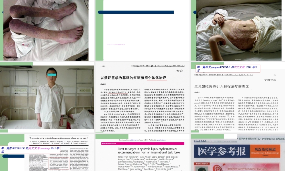 2022年医学专题—杨岫岩.系统性红斑狼疮(2015年省医).ppt