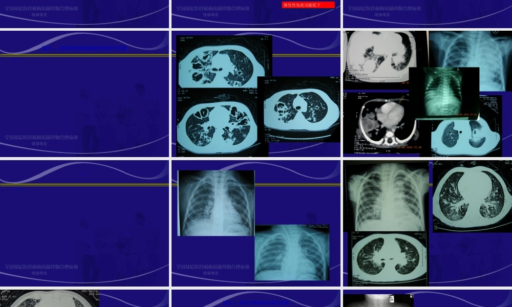 2022年医学专题—.儿童侵袭性肺部真菌感染的诊治-赵顺英(1).ppt