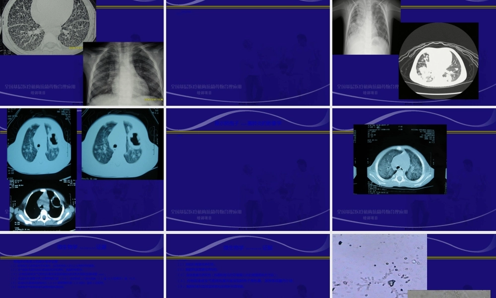 2022年医学专题—.儿童侵袭性肺部真菌感染的诊治-赵顺英(1).ppt