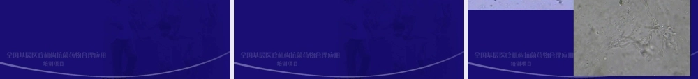 2022年医学专题—.儿童侵袭性肺部真菌感染的诊治-赵顺英(1).ppt