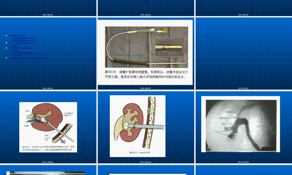 2022年医学专题—PNL的并发症(1).ppt