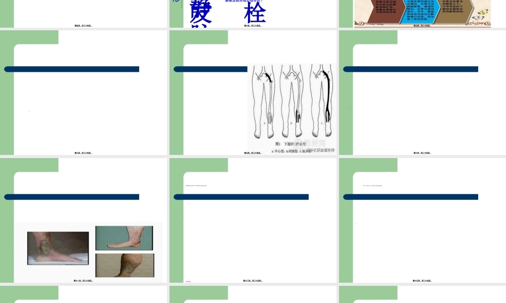2022年医学专题—下肢深静脉血栓(1).ppt
