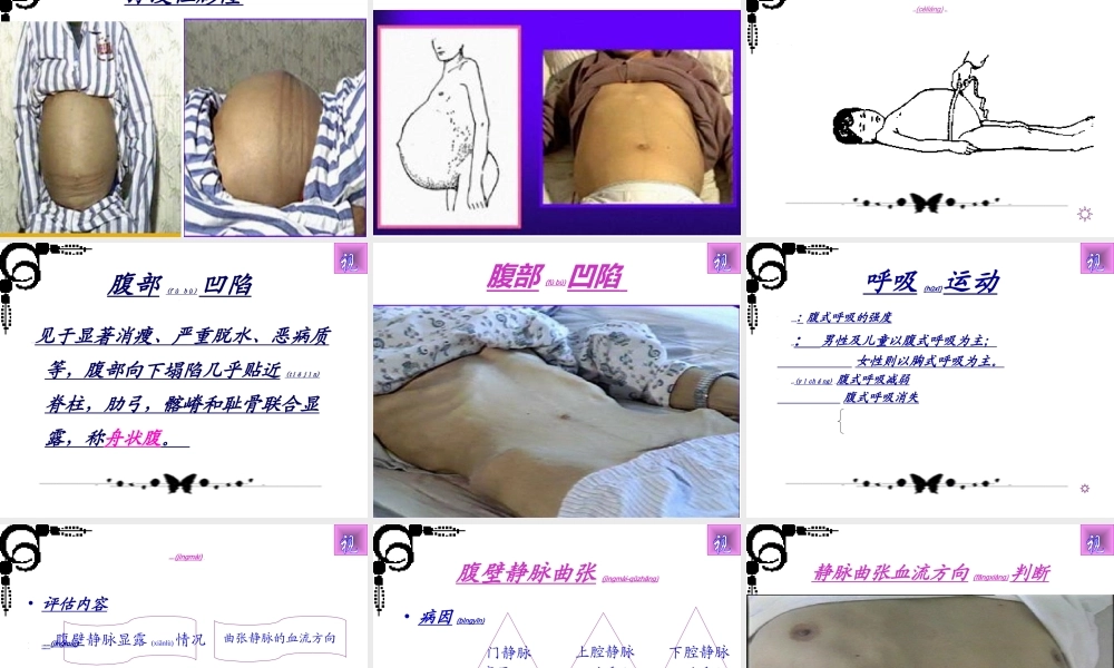 2022年医学专题—第七节--腹部评估.ppt