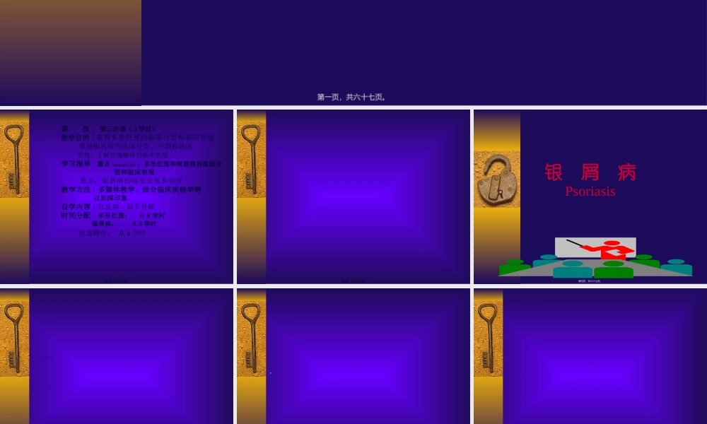 2022年医学专题—P-07红斑鳞屑性皮肤病(1).ppt