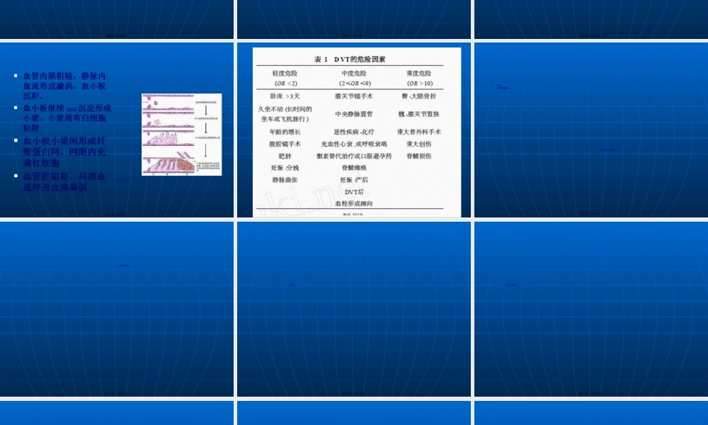 2022年医学专题—下肢深静脉血栓幻灯-周世芮(1).ppt