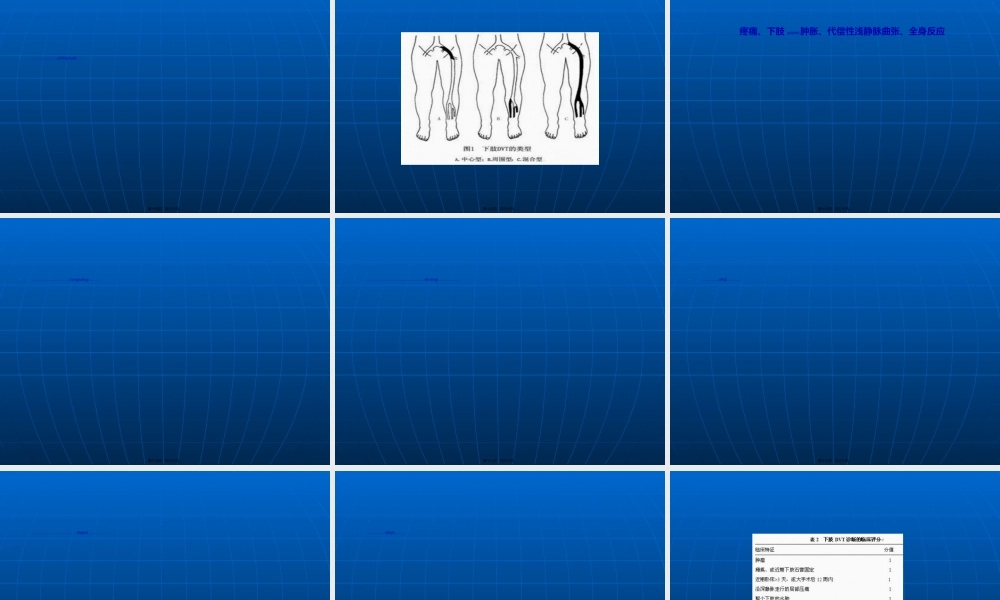 2022年医学专题—下肢深静脉血栓幻灯-周世芮(1).ppt