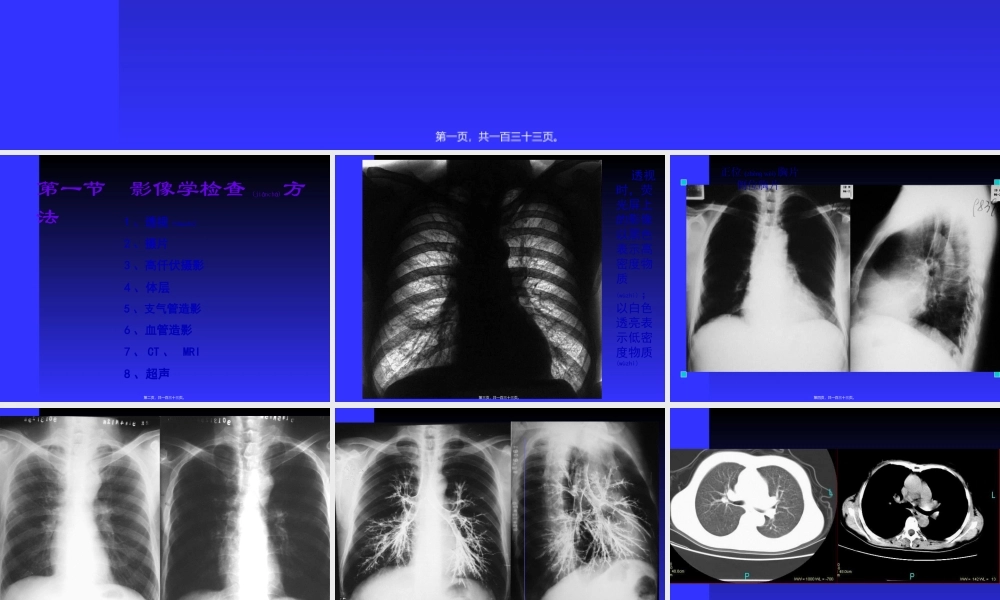 2022年医学专题—正常胸部影像学PPT.ppt