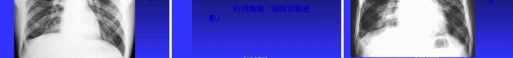2022年医学专题—正常胸部影像学PPT.ppt