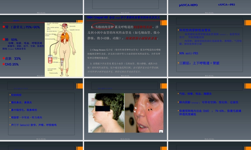 2022年医学专题—ANCA相关性小血管炎-.ppt