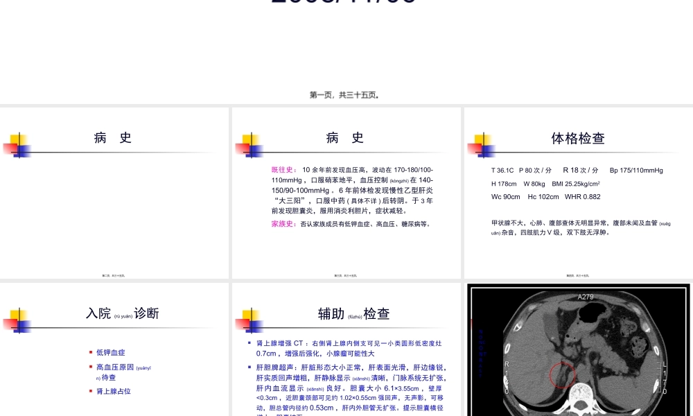 2022年医学专题—FANCONI？高血压-低血钾.ppt