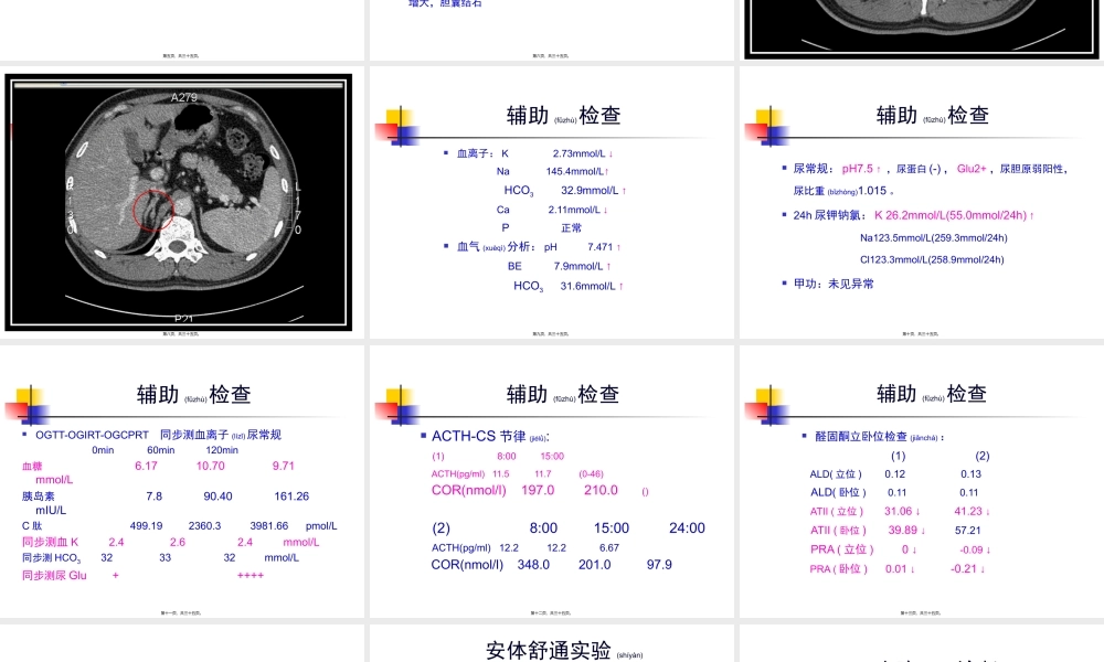 2022年医学专题—FANCONI？高血压-低血钾.ppt