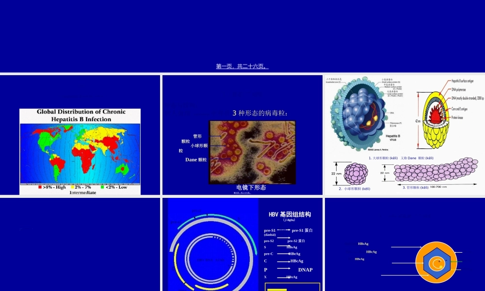 2022年医学专题—HBV-X-蛋白与原发性肝癌.ppt