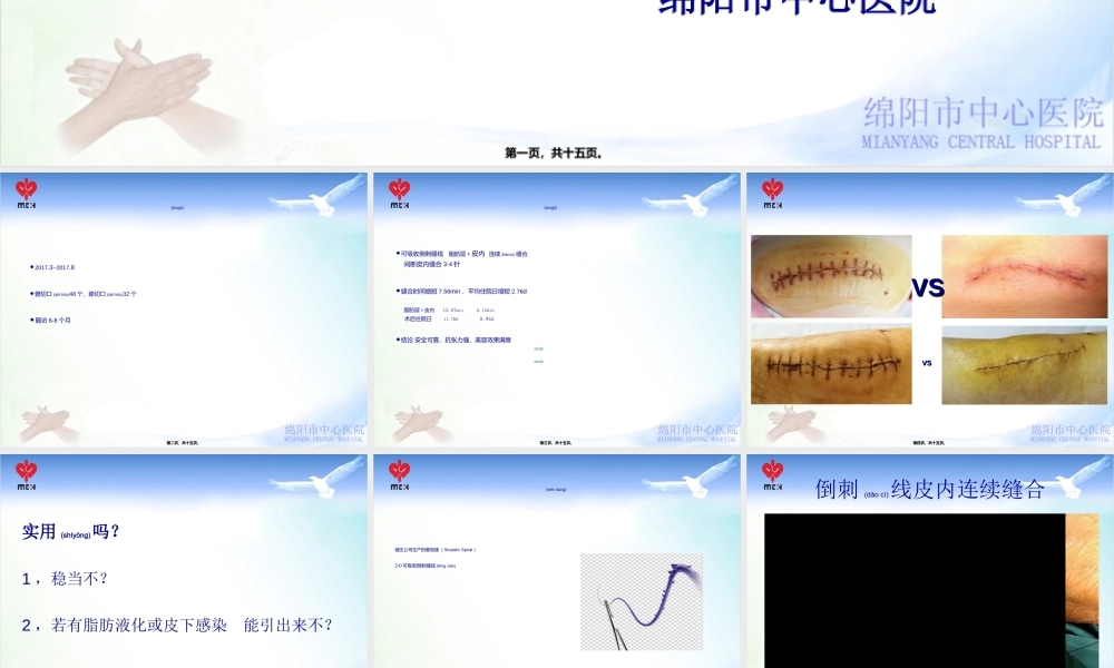 2022年医学专题—WMA加强的皮内连续缝合法在髋膝关节置换手术中的应用.ppt