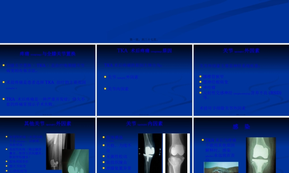 2022年医学专题—【王坤正】全膝关节置换术后膝关节疼痛的原因分析及处理.pptx