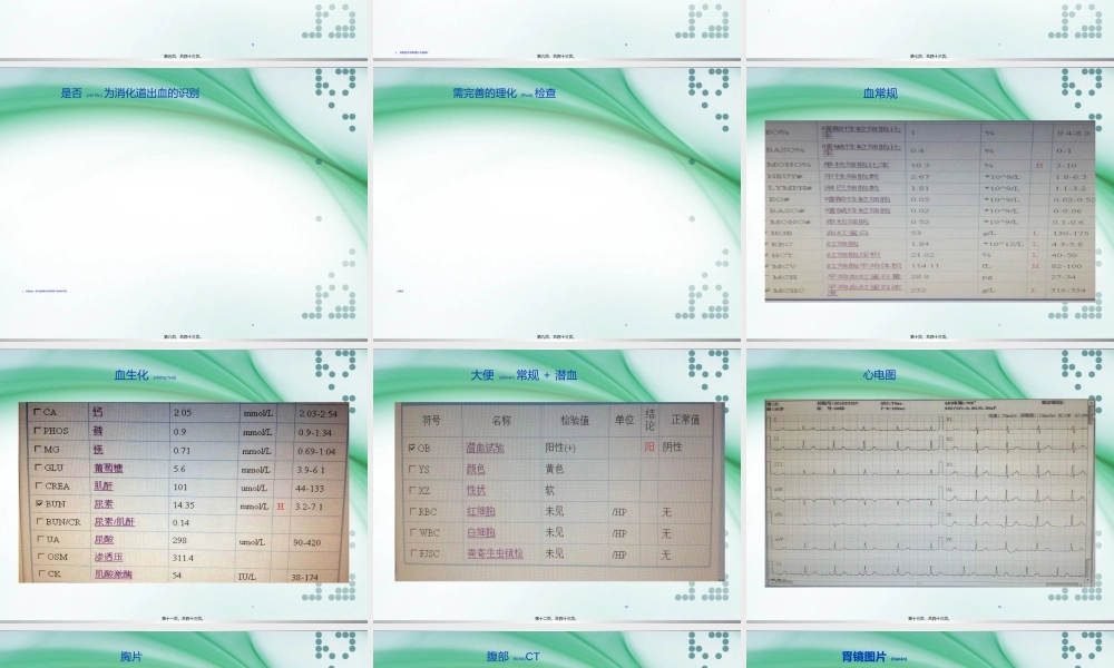 2022年医学专题—上消化道出血PBL教学.ppt