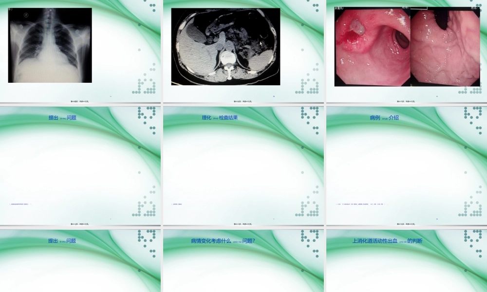 2022年医学专题—上消化道出血PBL教学.ppt