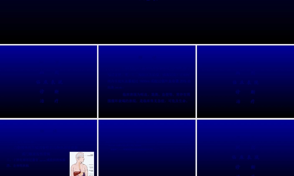 2022年医学专题—上消化道大出血(急).ppt