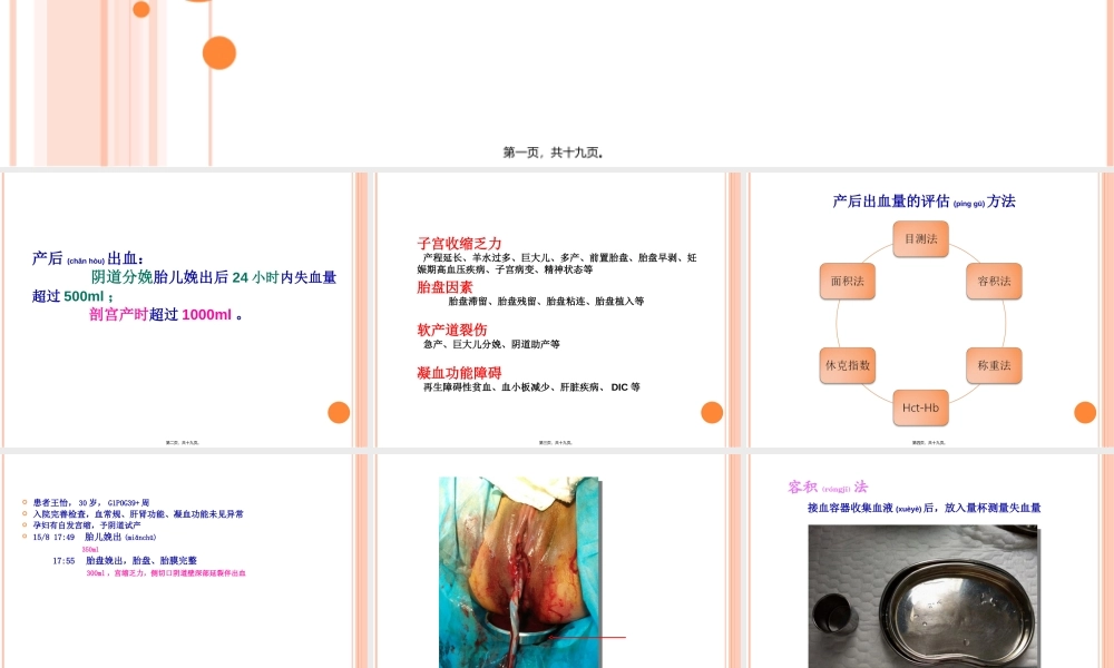 2022年医学专题—产后出血之出血量评估.ppt